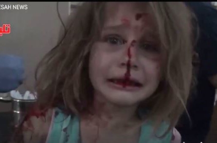 Bé gái Syria khóc tìm cha sau cuộc không kích khiến nhiều người rơi nước mắt