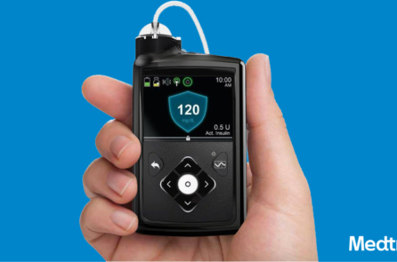 FDA chấp thuận sử dụng “tụy nhân tạo” cho bệnh nhân tiểu đường tuýp 1