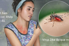 Thêm 2 ca nhiễm virus Zika tại Bình Dương và TP. HCM