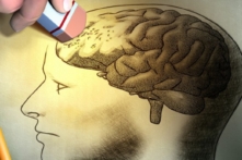 Loại thuốc mới đem lại hy vọng trong việc điều trị bệnh Alzheimer