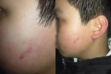 Đình chỉ dạy học cô giáo chủ nhiệm cho hơn 40 học sinh tát một bạn trong lớp