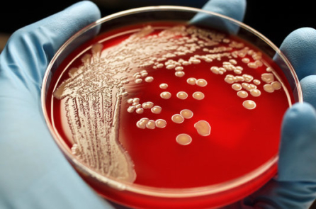 Mua thịt, cá, trứng thời nay, bạn sẽ “được” cả kháng sinh!