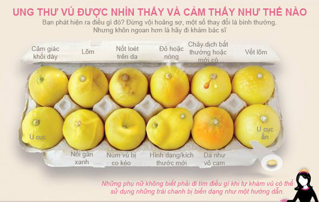 12 dấu hiệu có thể gặp khi bị ung thư vú (Ảnh: qua Dantri)