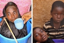 Cô gái Nigeria sống cả đời trong một chiếc thau nhỏ