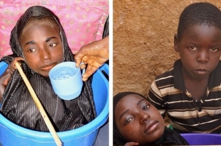 Cô gái Nigeria sống cả đời trong một chiếc thau nhỏ