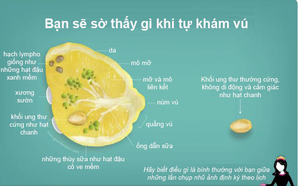 Mô tả tuyến vú qua hình quả chanh (Ảnh: qua dantri)