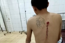 Đắk Lắk: Cho xe bỏ chạy, 3 thanh niên bị công an xã bắn bị thương