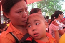 Mỗi nửa giờ có 4 người chết vì ung thư ở Việt Nam