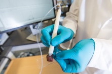 Bút ‘thần kỳ’ có thể phát hiện mô ung thư chỉ sau 10 giây (video)