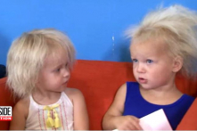 Gặp các bé gái bị “hội chứng tóc rối bù” hiếm gặp giống bác học Einstein