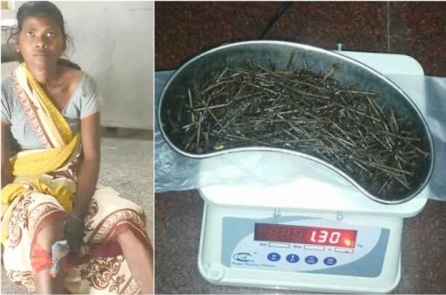 Chuyện lạ: Một phụ nữ Ấn Độ có hơn 70 cây đinh trong chân, bác sĩ chưa thể giải thích