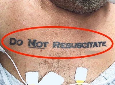Người đàn ông bất tỉnh nhập viện với hình xăm ‘đừng cứu sống’ khiến bác sĩ khó xử