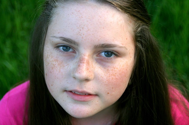 freckle face 765622 640