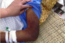 Nghệ An: Con trai hành hung cha tới gãy xương sườn, mẻ xương bánh chè