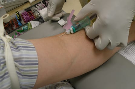 Đột phá mới giúp phát hiện sớm 8 loại bệnh ung thư