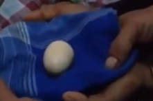 Cậu bé Indonesia “đẻ” 20 quả trứng trong 2 năm