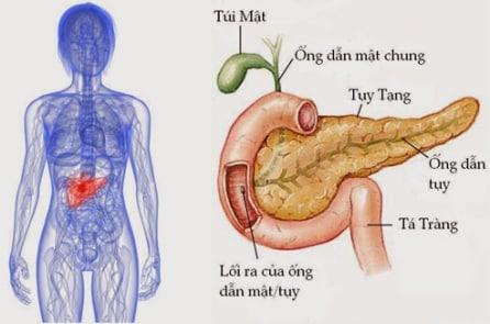 Ung thư tuyến tụy và những triệu chứng dễ bị bỏ qua