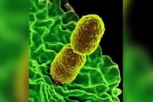 Phát hiện siêu vi khuẩn “ác mộng” ở 27 bang của Mỹ