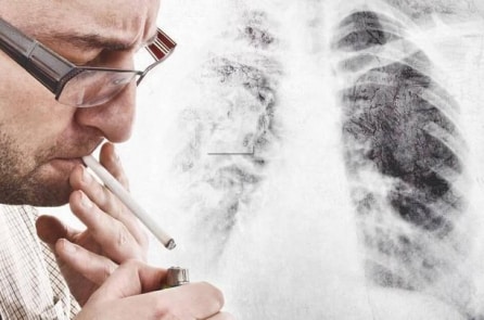 Sau cai thuốc lá, phần phổi thương tổn có thể phục hồi?