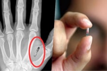 Trào lưu công nghệ ở Thụy Điển: Cấy chip vào bàn tay