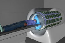 Máy quét y tế toàn thân đầu tiên trên thế giới, cho hình ảnh 3D ấn tượng