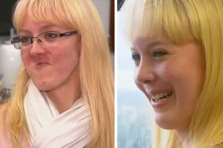 Úc: Lần đầu tiên cấy ghép hàm trên giả bằng công nghệ in 3D