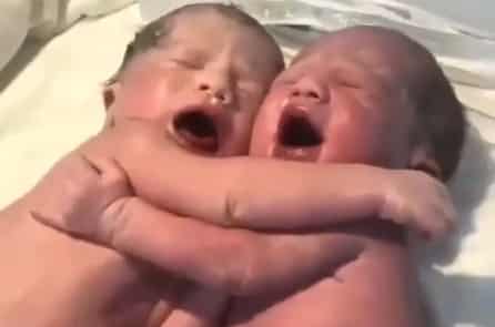 Cặp song sinh tìm được sự ấm áp trong khoảnh khắc ôm nhau