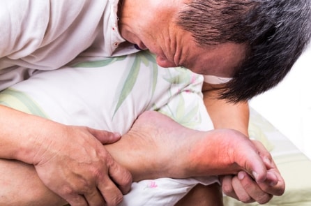 Bệnh gút là một tình trạng di truyền, bị kích hoạt bởi các yếu tố lối sống