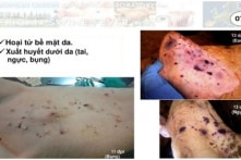 Dịch tả lợn châu Phi lây lan rộng: Khuyến cáo 9 biện pháp phòng ngừa