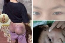 Công an viên đánh bé gái bị thiểu năng trí tuệ đến gãy răng, tụ máu mắt