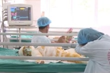 Tình trạng 3 trẻ bị bỏng do đốt cồn: Diện tích bỏng tới 60%, tiên lượng xấu