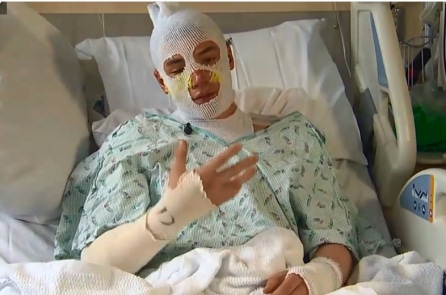 Thanh niên 20 tuổi dũng cảm xông vào đám cháy cứu cháu gái