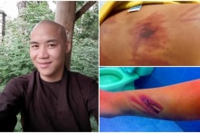 Một ‘người tu hành’ dâm ô, đánh đập bé trai 11 tuổi đến bầm tím người