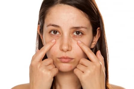 Làm cách nào để giảm thiểu bọng mắt và quầng thâm?