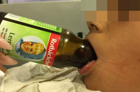 Giải pháp thông minh để kéo lưỡi của trẻ mắc kẹt trong chai