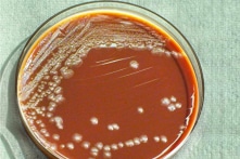 Trung Quốc: Phát hiện thêm ca bệnh dịch hạch nguy hiểm