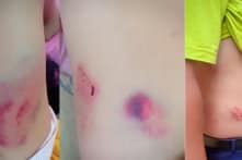 Không khởi tố Chánh văn phòng Huyện ủy đánh lái xe nhập viện