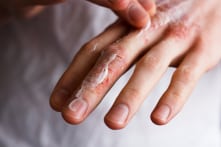 7 lời khuyên dưỡng da mùa đông từ bác sĩ da liễu