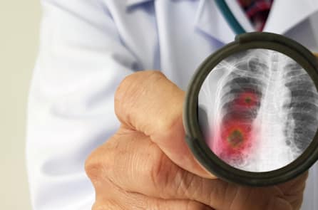 Hàn Quốc phát triển công cụ kiểm tra COVID-19 cho kết quả trong 1 giờ