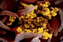 WHO đánh giá thấp khả năng lây lan của COVID-19?