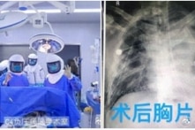 TQ: Thực hiện cấy ghép phổi đầu tiên cho bệnh nhân COVID-19