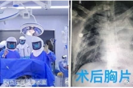TQ: Thực hiện cấy ghép phổi đầu tiên cho bệnh nhân COVID-19
