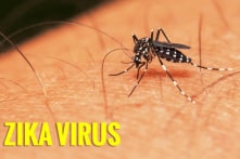 Phát hiện một bệnh nhân nhiễm virus Zika gây bệnh đầu nhỏ