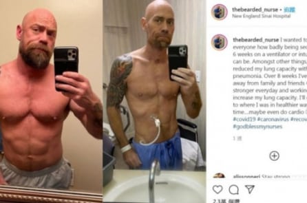 Sự khác biệt của người đàn ông trước và sau khi nhiễm COVID-19