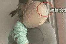 Y – Thương cấu kết bán sữa bột giả, Hồ Nam xuất hiện “em bé đầu to”