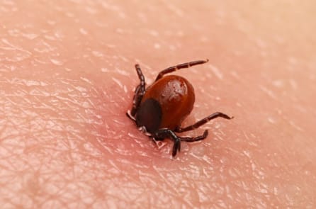 Một loại bệnh đang lan rộng ở New York có triệu chứng giống COVID-19