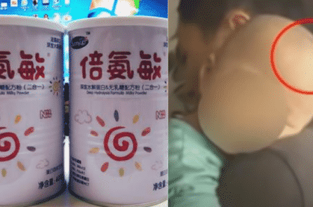 Trung Quốc: Sữa giả gây đầu to ở trẻ sơ sinh