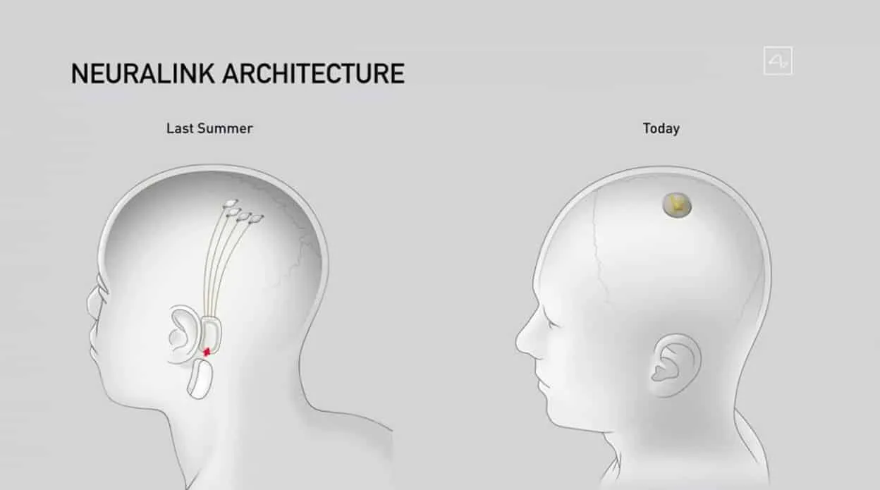 Elon Musk ra mat thiet bi doc nao nguoi Neuralink 4