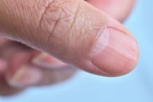 Hình bán nguyệt trắng trên móng tay nói gì về sức khỏe của bạn?