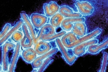 CDC Mỹ phát hiện virus hiếm gặp lây từ người sang người